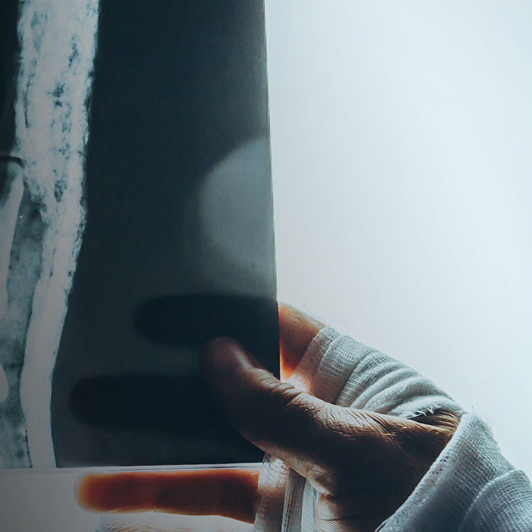 The patient is examining an x-ray of the hand